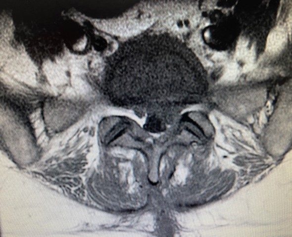 Radiology case #1_image4