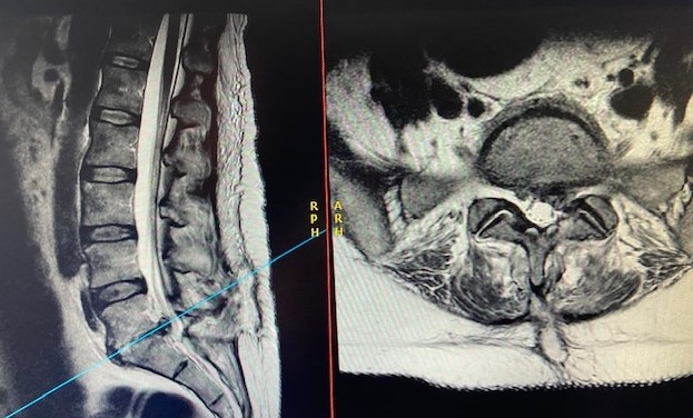 Radiology case #1_image3