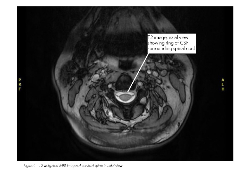 Radiology case #2_image1