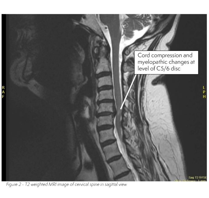 Radiology case #2_image 2