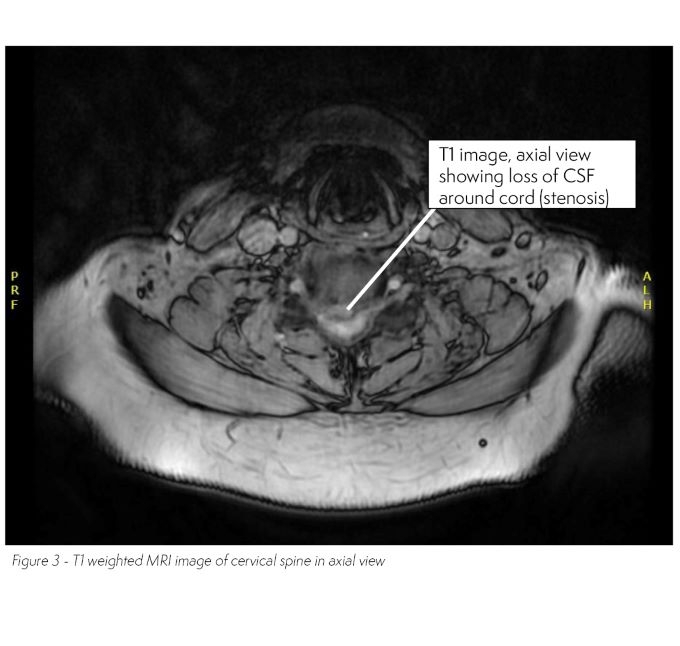 Radiology case #2_image 3