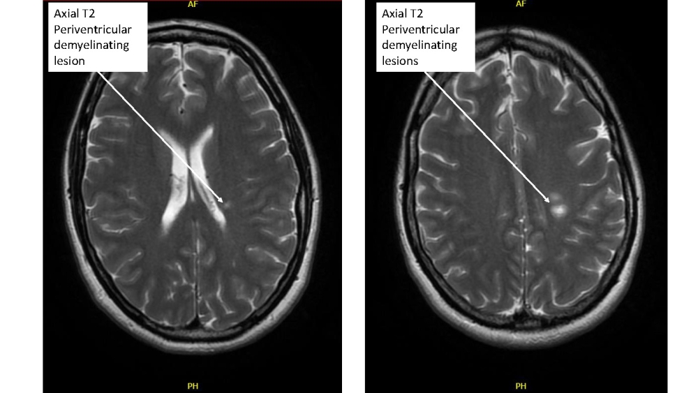 Radiology case #3_image12