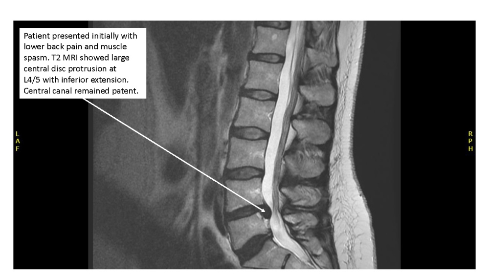 Radiology case #3_image3