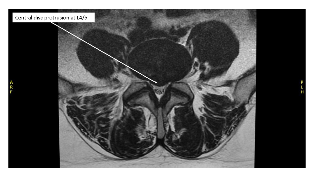 Radiology case #3_image4
