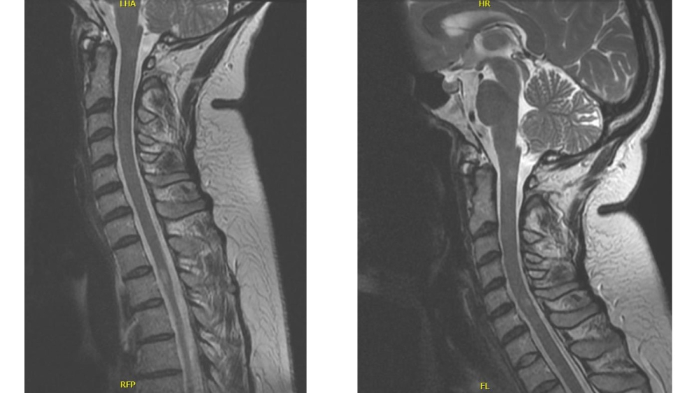 Radiology case #3_image9