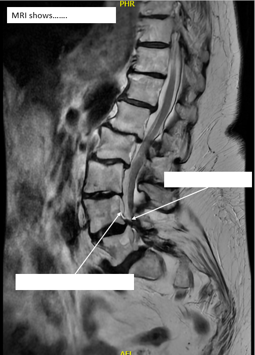 Radiology case #4_1