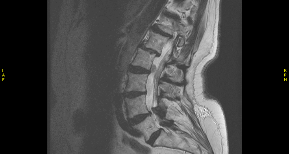 Radiology case #6_1