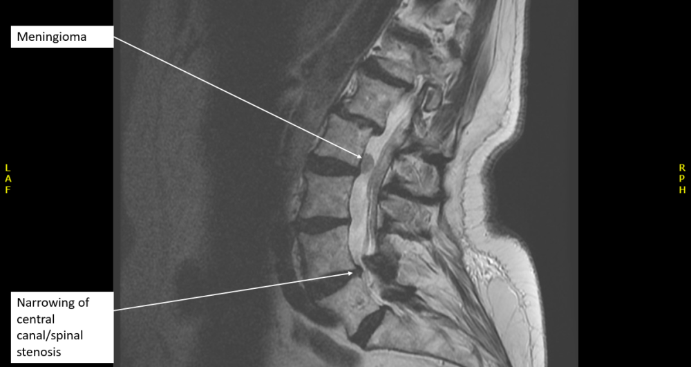 Radiology case #6_4