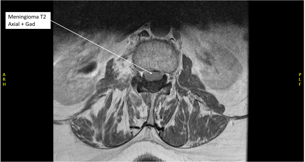 Radiology case #6_5