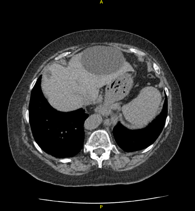 Radiology case #4_7