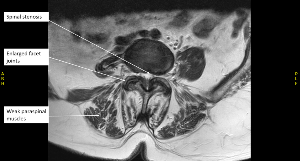 Radiology case #6_7