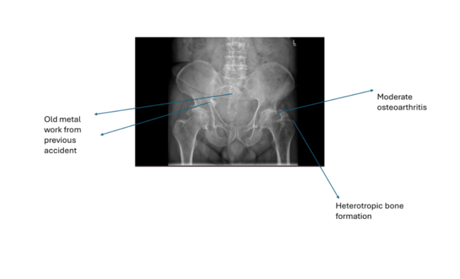 An X Ray image of the patient