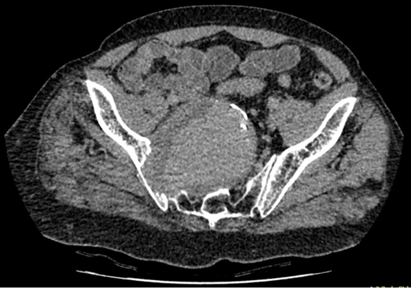 An X Ray image of the patient