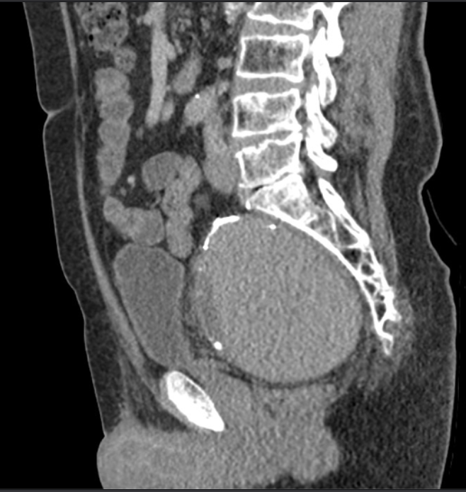 An X Ray image of the patient