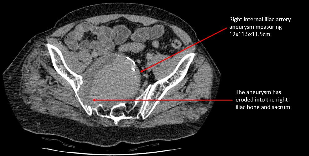 An X Ray image of the patient