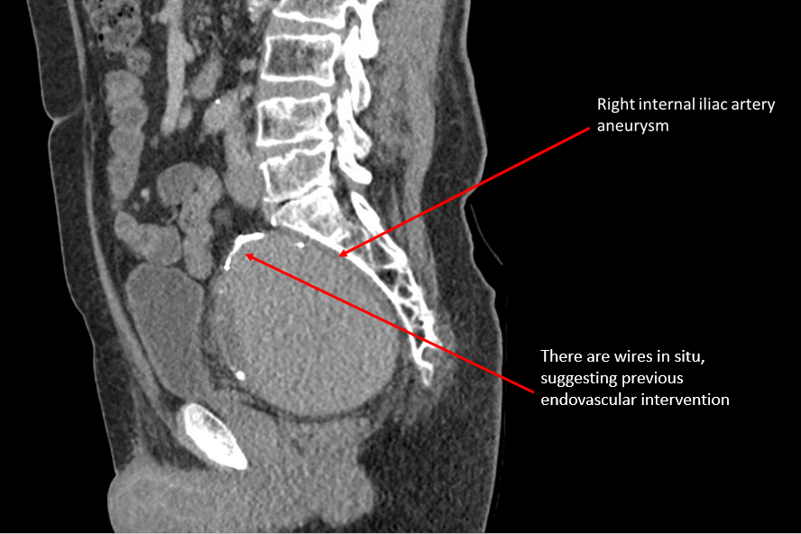 An X Ray image of the patient